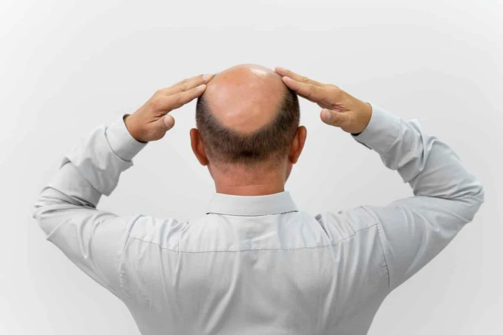 best-hair-transplant-turkey